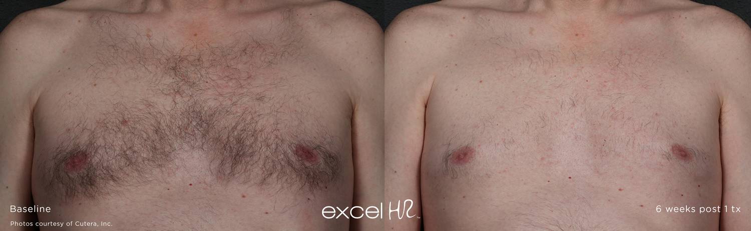 excel HR Before After